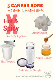Pin On Home Remedies