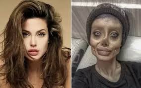 Which actor or actress has had a major surgical procedure while making a  movie?