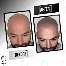 Ammar Mohammed H (@ammar.smp.sa) • Instagram photos and videos