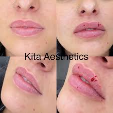 All our available appointments are visible on our online booking system. Kita Aesthetics Home Facebook