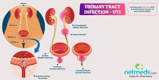 They are one of the most common types of infection and account for around 8.1 million visits to a doctor every. Urinary Tract Infection Uti Causes Symptoms And Treatment