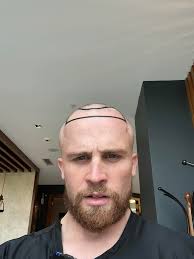 LOOK AT THIS!!! 🤩 💇‍♂️New hair, a year...