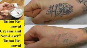 To support the valid concept of removing a tattoo with the help of hydrogen peroxide at home, it is said that hydrogen peroxide alone cannot perform well, but when used along with baking soda, works effectively and easily removes the tattoo from the. How I Remove Tattoos With Lemon Juice And Baking Soda At Home My Experience Lightening Youtube