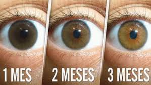 Que son las cataratas en los ojos. Pin En Gym