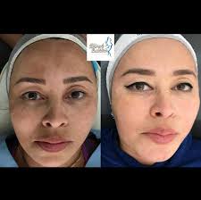 Mundo Estetico Spa y Peluqueria