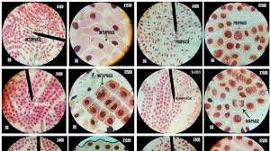 We did not find results for: Onion Root Tip Cell Division Stages At Different Magnifications X400 X675 X1500 Youtube