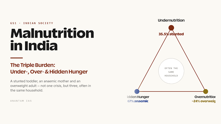 The triple burden of malnutrition affecting developing nations, AI generated