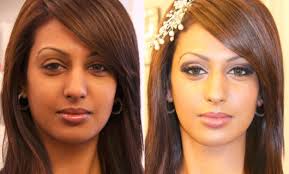Before And After Black And White Bleaching Cream Reviews Pin On Beauty