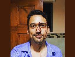 Uzivatel Telenoticias Na Twitteru Video Muestra A Seguridad De Bar En La Calle De La Amargura Burlandose De Hombre Golpeado Por Supuestamente Defender Gays Https T Co Skxpfyizjk Https T Co 9qojs4u0kf Twitter