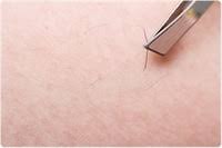 Not only does aspirin naturally contain salicylic acid, but honey also has antibacterial properties, which can help reduce the possibility of inflammation and infection, 3 ﻿ says kautilya shaurya, md, a dermatologist at schweiger dermatology group in new york. Preventing Ingrown Hairs