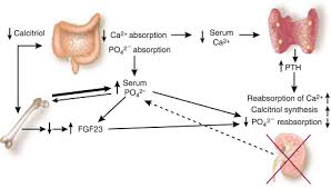 Image result for Hyperphosphatemia