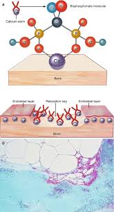 Image result for Bisphosphonates