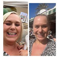 Anyone 5 ft tall and start at 250lb with the sleeve? I know everyone loses  differently but I'd like to see some before and after photos. Please and  thank you!