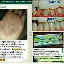 Pernah mengalami sakit gusi bengkak, kalau sudah bagaimana pendapat anda tentang hal itu. Solihah Herbalis Nasa Home Facebook