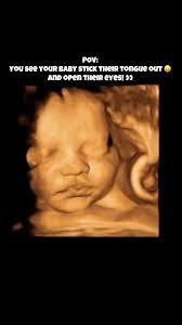 “Before I formed you in the womb I knew you, and before you were born I  consecrated you.” Jeremiah 1:5