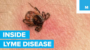 What S The Deal With Lyme Disease Sharp Science Youtube
