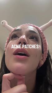 Probando parches de granos: ¿Realmente funcionan?