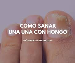 Hongos En Las Uñas De Las Manos Como Eliminarlos Tratamientos Eficaces Para Eliminar Hongos De Las Unas En 2020 Eliminar Hongos De Las Unas Eliminar Hongos Hongos Unas Pies