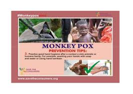 Symptoms begin with fever, headache, muscle pains, swollen lymph nodes, and feeling tired. Monkeypox Prevention
