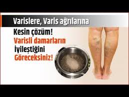 Varisli Damarlara Iyi Geliyor Varislere Cozum Youtube 2020 Varis Recete Artrit