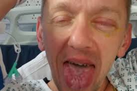 Twisted Paul Elliot jailed after ammonia attack