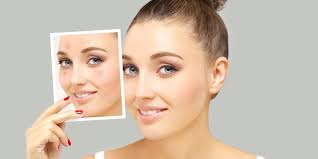 Adakah cara untuk menghilangkan bopeng bekas jerawat? Efek Buruk Begadang Bisa Sebabkan Jerawat Bermunculan Kok Bisa Halaman All Kompas Com