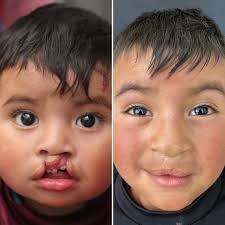 Behind every transformed smile is a...