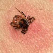 Image result for infected tick bite