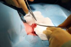 Try dragging an image to the search box. Circumcision Preparation Recovery Long Term Care