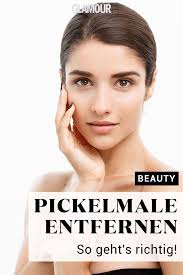 Was alle pickel jedoch gemeinsam haben: Pickelmale Entfernen So Geht S Richtig Pickel Pickel Wegbekommen Hautpflege Tipps
