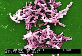 Consult a doctor for medical advice. New Drug Stops Deadly Superbug Infection