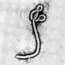 Feb 26, 2021 · it is sometimes difficult to know if a person is infected with the ebola virus; Ebola Virus Virus Images Utmb Home