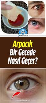 Gozde Arpacik Sorunu Icin Dogal Cozum Faydali Bilgin Dogal Saglik Dogal Gozler