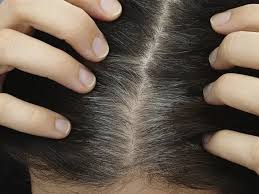 Ancient ayurveda hand outs natural and potential solutions to combat grey hairs while resolving the underlying issues. 15 Best Home Remedies To Treat Grey Hair Styles At Life