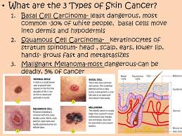 Here you'll see what the most common types of skin cancer can look like and who tends to develop each type. Skin Cancer 4 13 17 Page 93 Rs Ppt Download