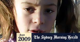 High-tech brain surgery keeps girls alive