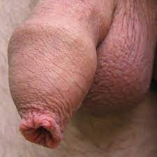 Uncut pennis