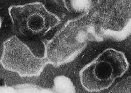 In der regel ist der verlauf des pfeifferschen drüsenfiebers mild und harmlos. Epstein Barr Virus Wikipedia