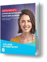 Upper and lower implants needed. Deciding If Dental Implants Are Right For You College Of Dentistry University Of Illinois Chicago