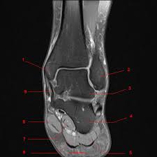 Almost every muscle constitutes one part of a pair of identical bilateral. Mri Of The Ankle Detailed Anatomy W Radiology