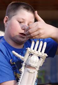 Robohand uses 3D printing to replace lost digits