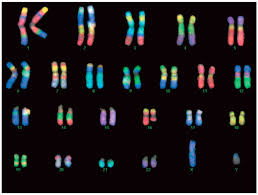 See full list on healthline.com Solved A How Does A Robertsonian Translocation Differ From A Reciprocal Translocation B Suppose A Robertsonian Translocation Occurs In The Germlin Course Hero