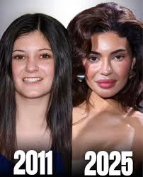 Kylie Jenner Then vs Now & Nia Long Then vs Now👀