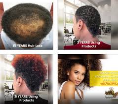 The natural hair care market is taking over!!! Private White Label Best Minoxidil Hair Cream With Biotin And Hemp Oil Amwiner Raphe Holdings Skin Care Private Label Wholesale Laboratory