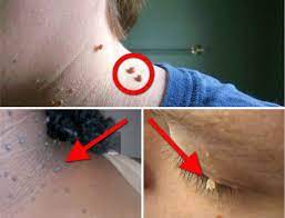 / check spelling or type a new query.we did not find results for: Bagi Anda Yang Punya Tumor Fibroid Atau Kulit Berlebih Di Tubuh Begini Cara Bersihkan Sila Share Malaysia Berita Online Semasa Mybos