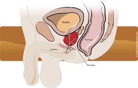 When malignant cancer cells form and grow within a person's breast tissue, breast cancer occurs. Urology And Urologic Surgery P C Urologists Knoxville Tn Davinci Robotic Prostatectomy