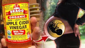 Apple Cider Vinegar And Pregnancy First Trimester Pregnancywalls