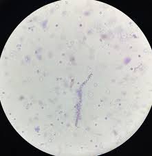 Image result for Spirochete
