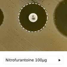 There are hundreds of fitness apps on the market, and. Pdf The First Ai Based Mobile Application For Antibiotic Resistance Testing