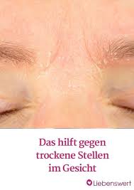 Vor Allem Im Winter Treten Sie Auf Trockene Stellen Im Gesicht Die Sich Mit Make Up Nicht Uberdecken Lassen Trockene Haut Gesicht Gesicht Trockenes Gesicht